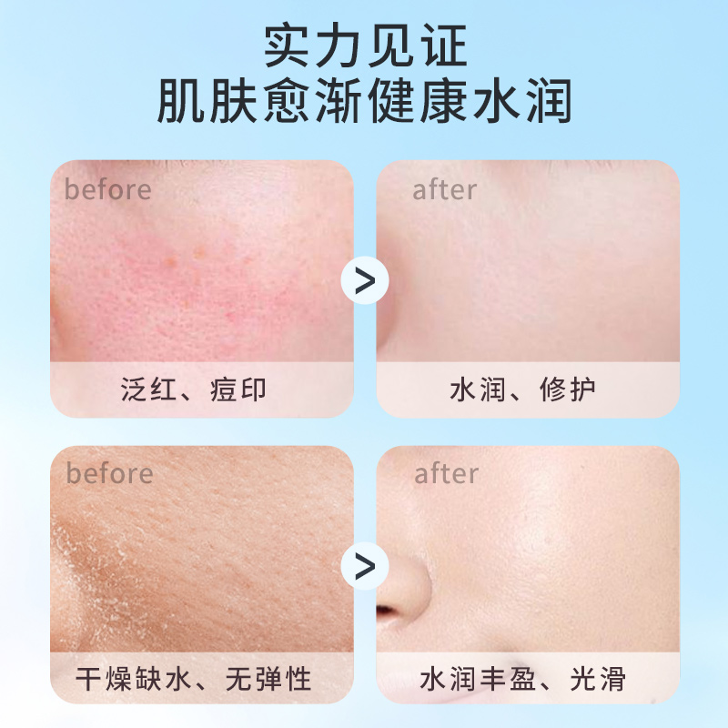 维生素B5修复面霜屏障保湿补水去淡化痘印痘坑多效舒缓泛红积雪草