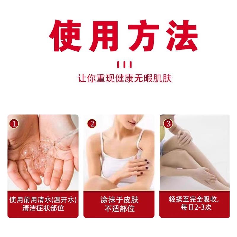 地奈德乳膏正品官方旗舰店15g/支布地奈德软膏婴儿外用耐德奈得 - 图2