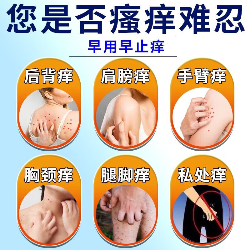 治皮肤瘙痒过敏止痒药膏真菌感染皮炎湿疹皮癣身上起红疙瘩红点痒 - 图1