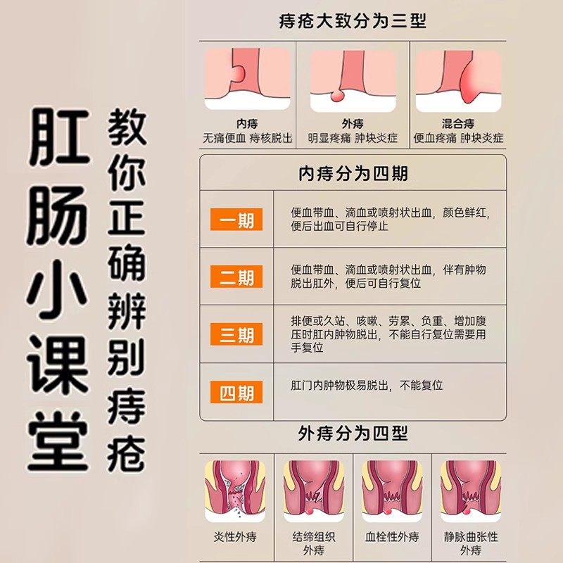马应龙痔疮膏正品痔疮专用药瘙痒大便出血肿胀疼痛内痔外痔混合痔