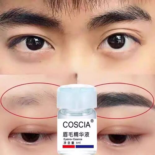 Minoxidil 5% Follicle Boosting Serum, Volumizing, Keratin - 图0