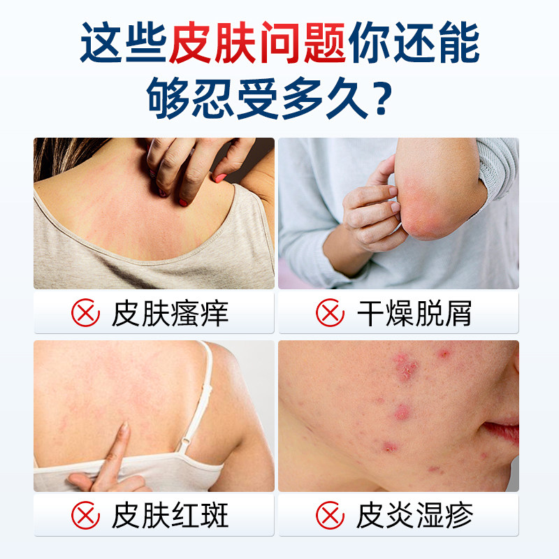 亚国宁皮肤喷剂官方旗舰店正品医用皮炎痤疮湿疹止痒喷剂护理敷料,淘宝优惠券,粉丝福利购,淘宝优惠卷