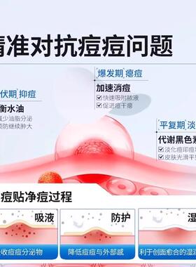 卡通星星痘痘贴修覆消炎痘印去豆贴隐形净痘可爱吸脓人工皮水胶体