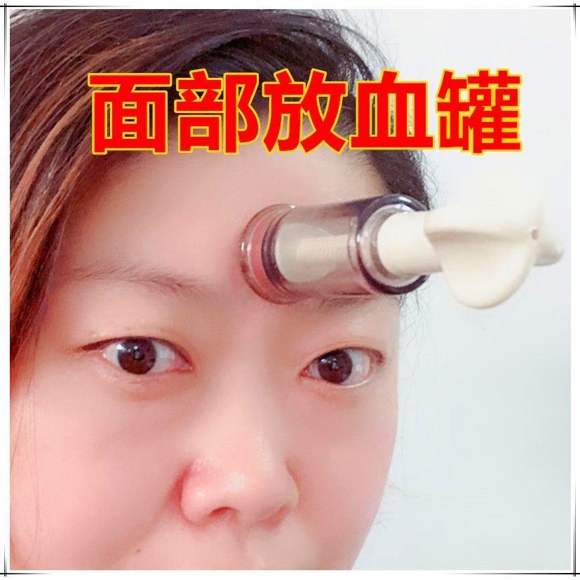 面部泄血罐放血罐脸部拔罐器拔青春痘粉刺吸罐手拧吸力大力度美容