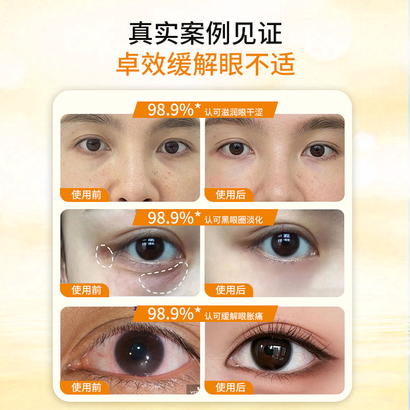 葵花医用眼部热敷贴消肿消炎止痛发热干眼症蒸汽眼罩缓解眼疲劳