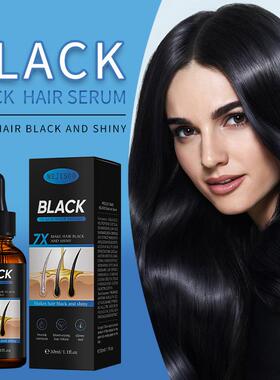 跨境头发生长精华液护发精油Hair Serum生姜黑发精油外贸