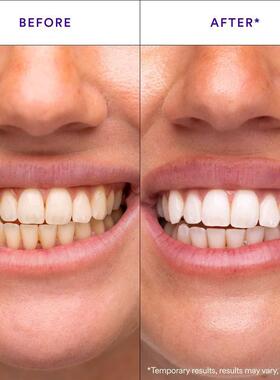 V34 Whitening Strips 牙贴  牙齿清洁护理牙贴片