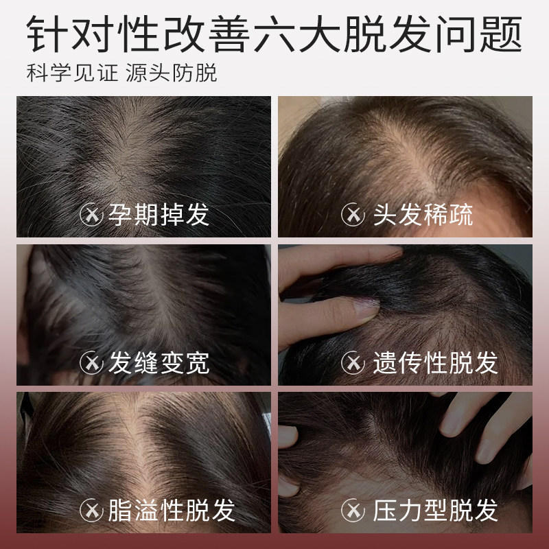 【三瓶装】达尼丝防脱洗发乳侧柏叶洗头固发强韧净油丰盈蓬松柔顺