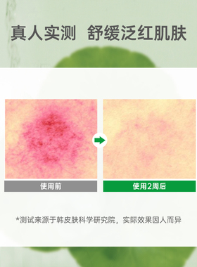 唯拉珠积雪草高保湿舒缓褪红面霜