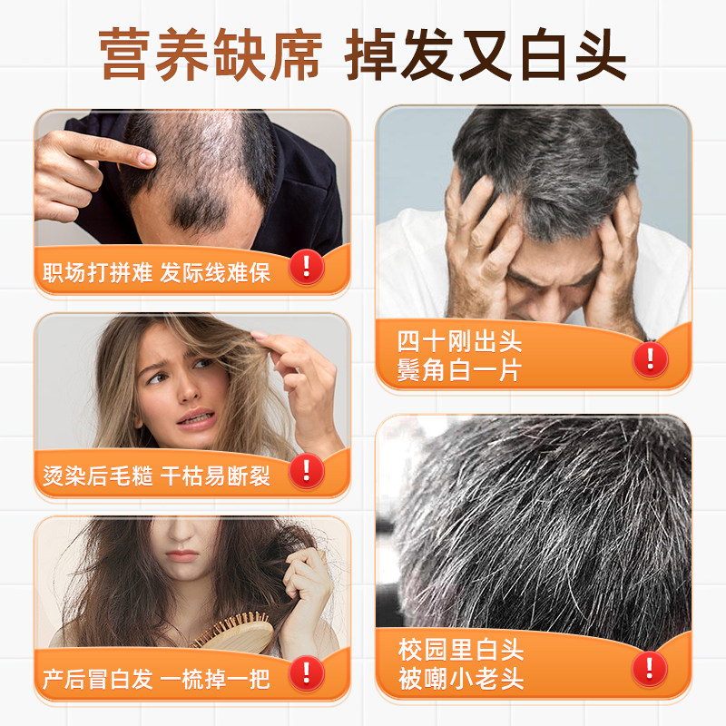 AIAF艾弗维生素B族乌发素白发脱发生物素黑发养发男女,淘宝优惠券,粉丝福利购,淘宝优惠卷