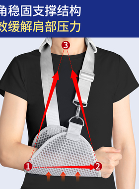 胳膊手臂前臂骨折石膏吊带