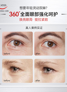 【升级版】Dr.E.Voss德沃希HYA 5 360全能焕活眼部精华KO眼袋泪沟