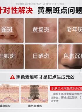 烟酰胺凝胶美抗氧化白去黄提亮改善暗沉肤色祛黄褐斑雀斑面霜