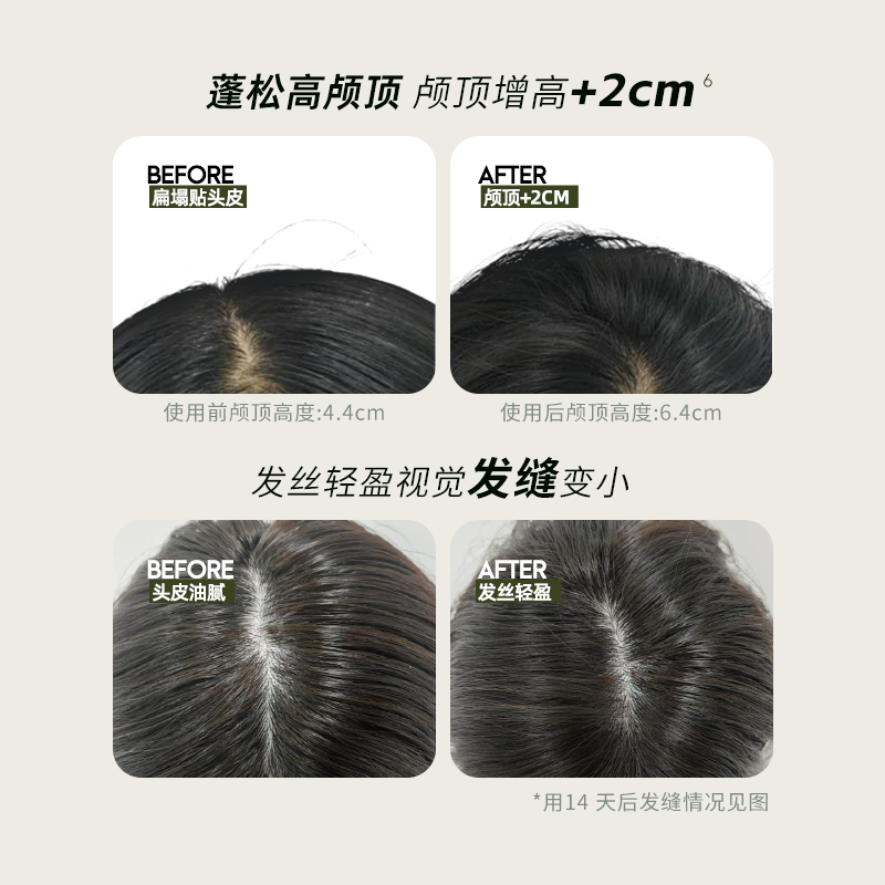 福瑞达即沐蓬蓬免洗洗发水嘭嘭玻尿酸敏感肌可用控油高颅顶免洗,淘宝优惠券,粉丝福利购,淘宝优惠卷