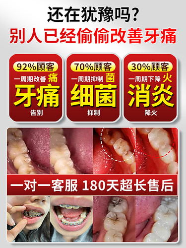 牙疼止疼药速用效专药消炎牙龈肿痛治牙痛止痛特药效止痛牙痛药水 - 图0