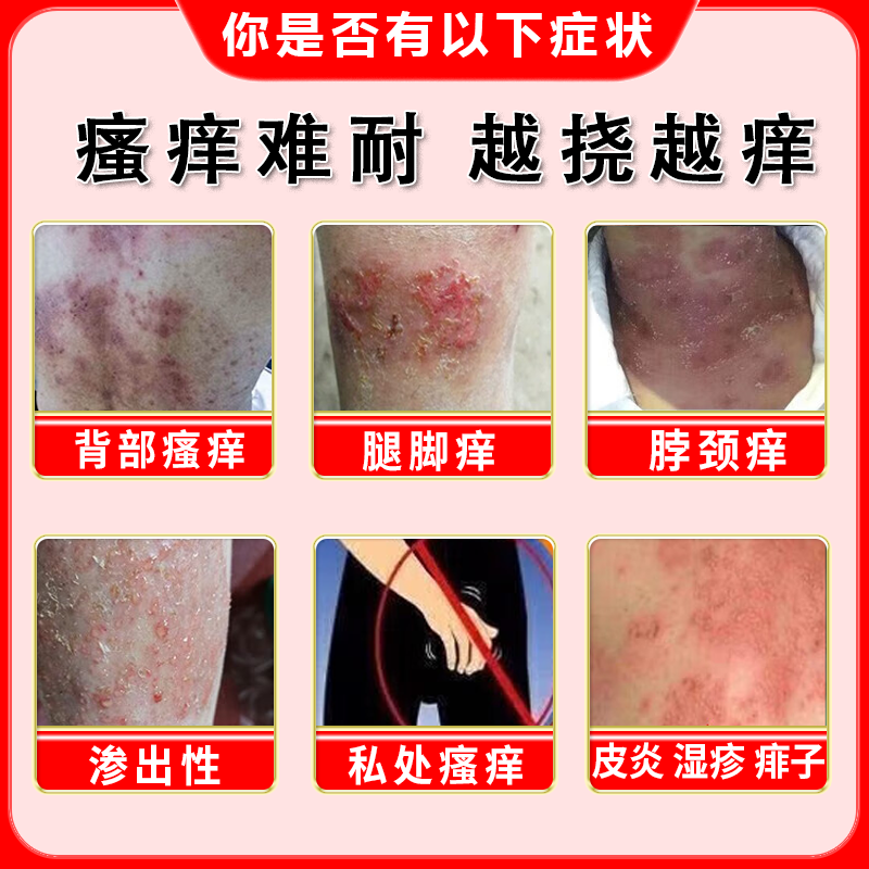 湿疹止痒去外用皮炎平999糠酸莫米松凝胶软膏根正品官方旗舰店,淘宝优惠券,粉丝福利购,淘宝优惠卷