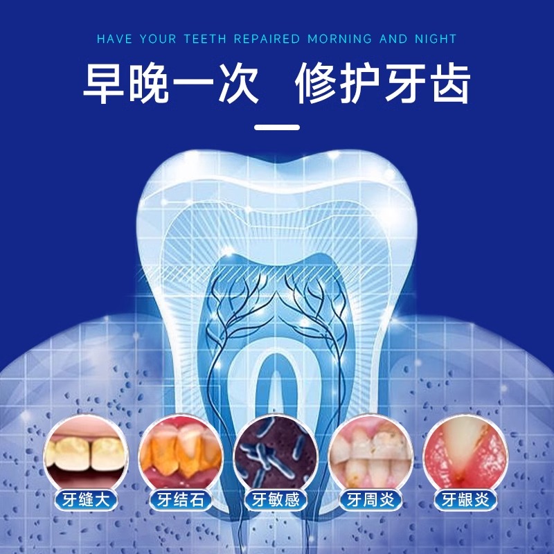 【香港大药房官方正品】修复敏感固齿牙结石去除溶解祛牙石牙质 - 图2