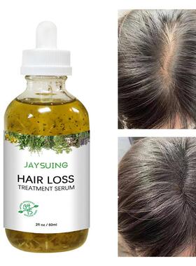 好货Hair Growth Essence Oil Oil Anti Hair Loss Fast Growing