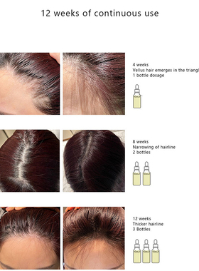 好货60ml Hair Growth Essential Oil Anti Hair Loss Fast Growi