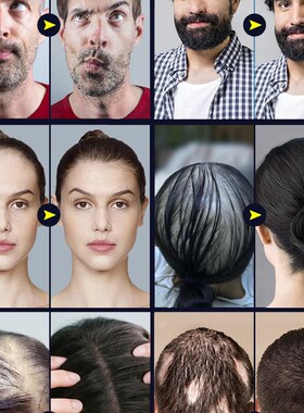 好货Hair Growth Oil Fast Hair Growth Effective Treatment for
