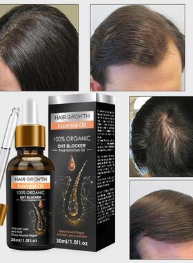 好货NEW Alopecia Hair Treatment for Women Growth Hair Oil Fa