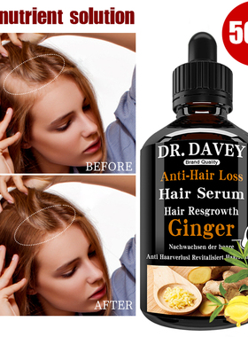 好货Hair Growth Products Natural Anti Hair Loss Prevent Bald
