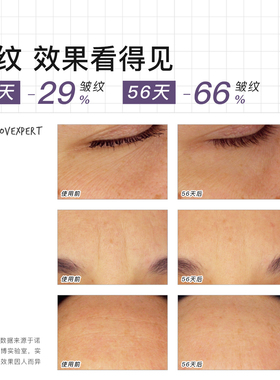 【U先试用】视黄醇精华试用装0.7ml*4片+50元优惠券 限购1份