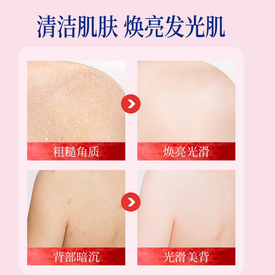果酸磨砂膏身体嫩白全身去角质去死皮去鸡皮疙瘩美手部去黑色素
