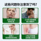 Solgar US ນໍາເຂົ້າ chelated zinc supplement glycinate zinc tablets ສໍາລັບຜູ້ຊາຍຜູ້ໃຫຍ່ເພື່ອເສີມເຊື້ອອະສຸຈິເພື່ອເພີ່ມພູມຕ້ານທານ