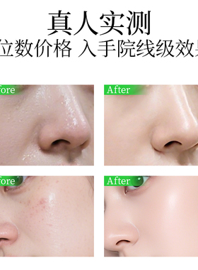 U牌薰衣草纯露补水舒缓控油喷雾