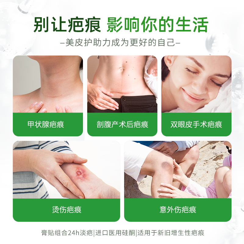 【自营】美皮护Mepiform疤痕贴增生疤痕双眼皮疤痘印硅酮凝胶