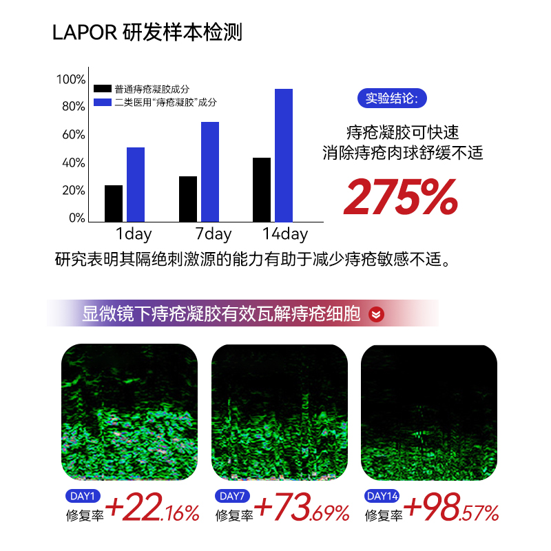 LAPOR医用痔疮凝胶敷料消肛门粘膜内外混合痔大便出血缓解痔疮B LAPOR医用痔疮凝胶敷料消肛门粘膜内外混合痔大便出血缓解痔疮B