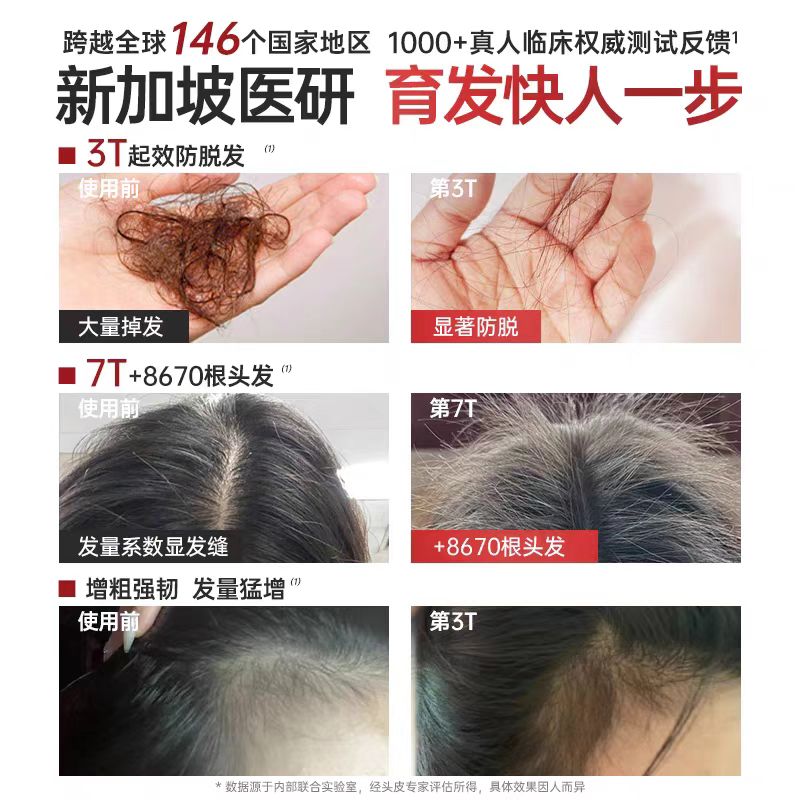 【强韧发根】头发滋养精华液防脱生发久黑不反白男女通用