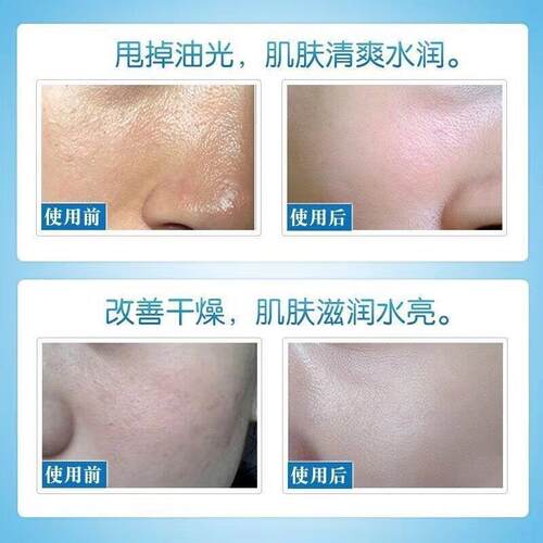 玻尿酸原液官方旗舰店正品次抛精华液医面部用补水保湿收缩毛孔 - 图0