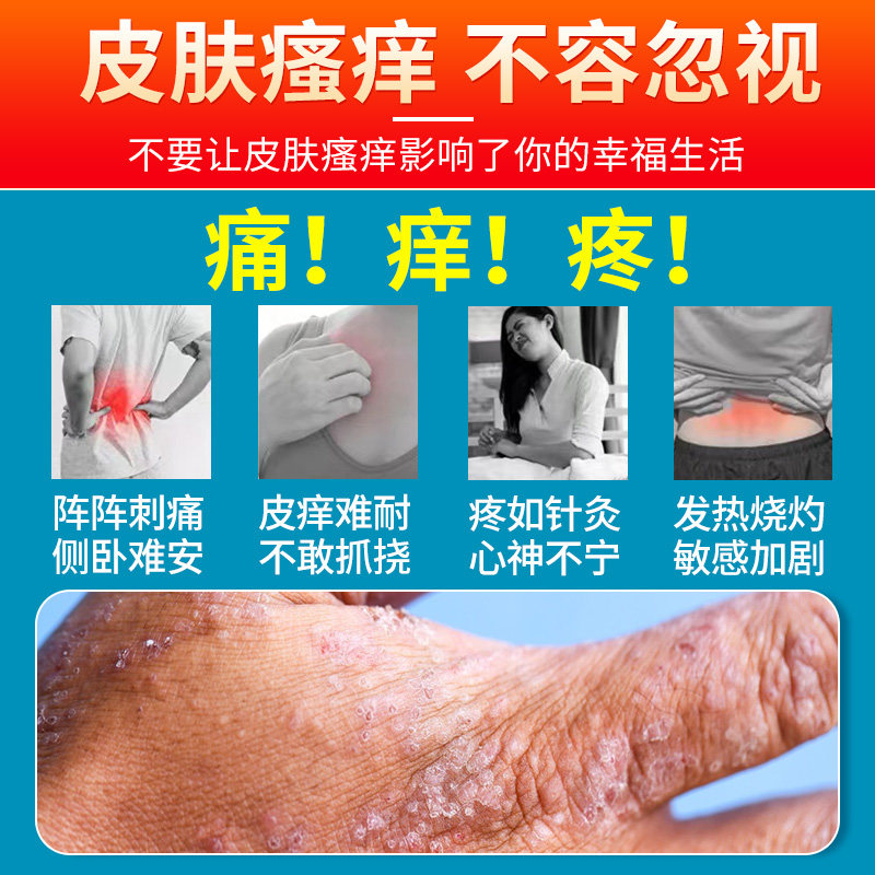 皮肤瘙痒止痒外用的非特疗效药膏老年成人冬季否专治干燥过敏起皮 - 图0