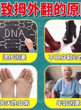 【10万人+已纠正】拇指变形肌贴防摩擦走路疼磨脚贴温和草本贴