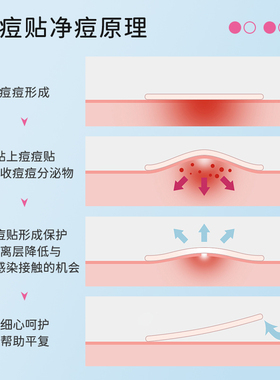 AUSLKA痘痘贴物理吸脓