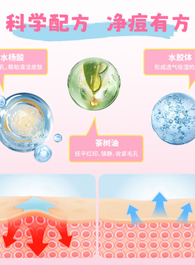 AUSLKA180贴星星痘痘贴