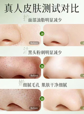 离岛日记维生素B7氨基酸洗面奶去黑头粉刺收缩毛孔清洁控油旗舰店
