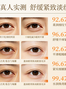 梵婕缇蛇毒肽淡纹果纤眼膜眼贴
