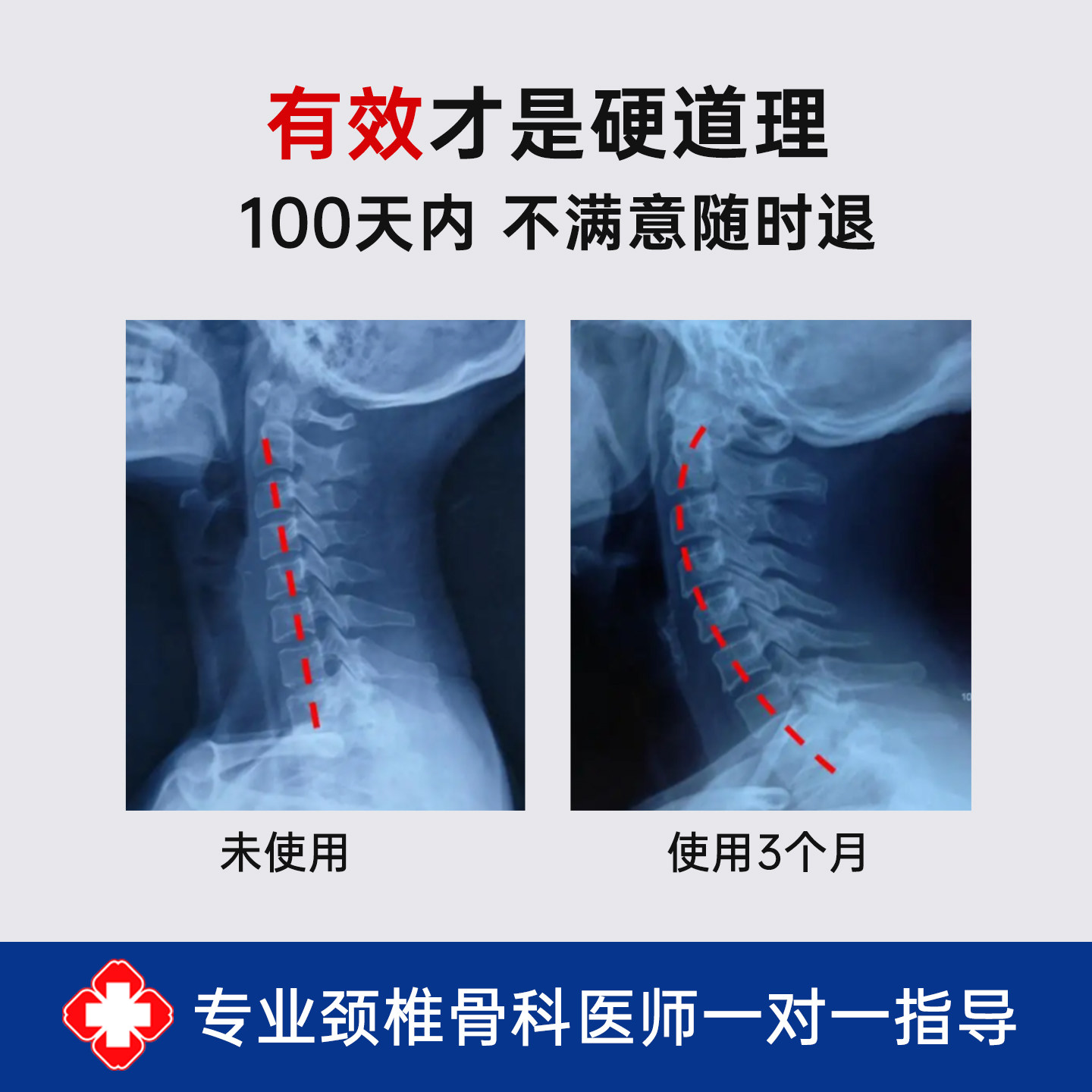颈椎按摩器生理曲度变直反弓牵引矫正仪护颈康复器肩颈枕理疗家用,淘宝优惠券,粉丝福利购,淘宝优惠卷