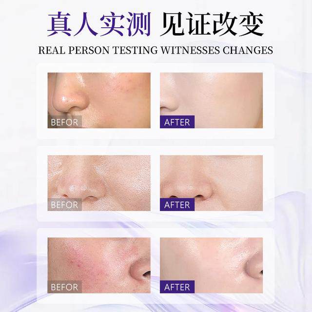 加拿大原装进口LFLF冰川泥净肤焕颜洁面乳-图2