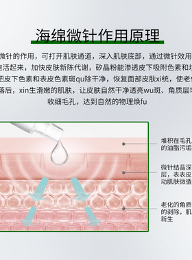凯镁晶海绵微针小绿膜套盒95针感