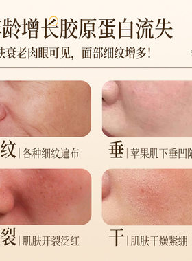 （贵州同款）缫丝花面霜黄芪霜