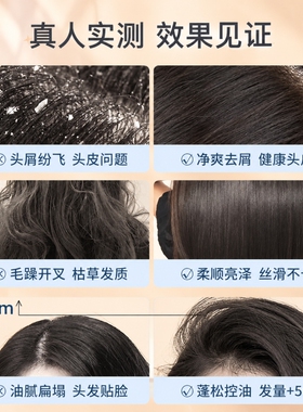 OKADY去屑止痒控油清爽二硫化硒洗头水清洁洗发露蓬松洗发液秋冬