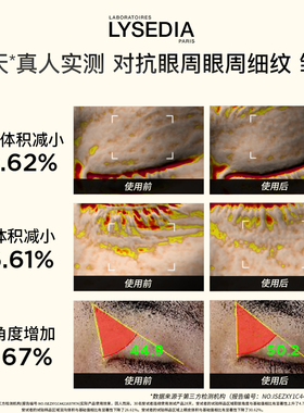 【张俪同款】lysedia黄金线眼霜保湿润泽抗皱紧致眼部精华女15ml