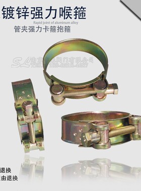 镀锌强力喉箍卡箍 水管卡管箍油管管夹 固定卡子管夹强力卡箍抱箍