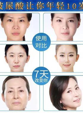 全分子量玻尿酸原液精华店正品美容院专用保湿补水爽肤水