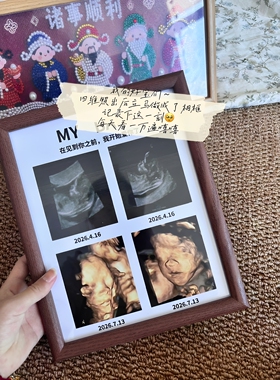 孕期B超单不要丢这样做超有意义