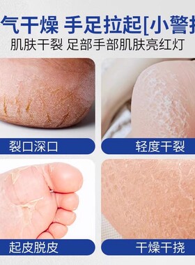 优优博士水润倍护身体凝露手足